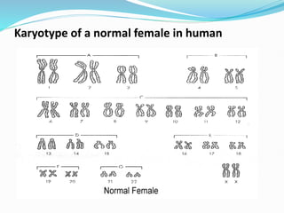 Karyotype of a normal female in human
 