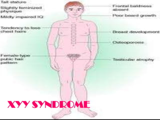 XYY SYNDROME
 