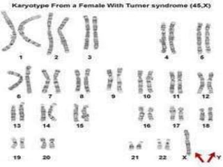 Chromosomal aberrations