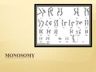 Chromosomal aberrations | PPTX