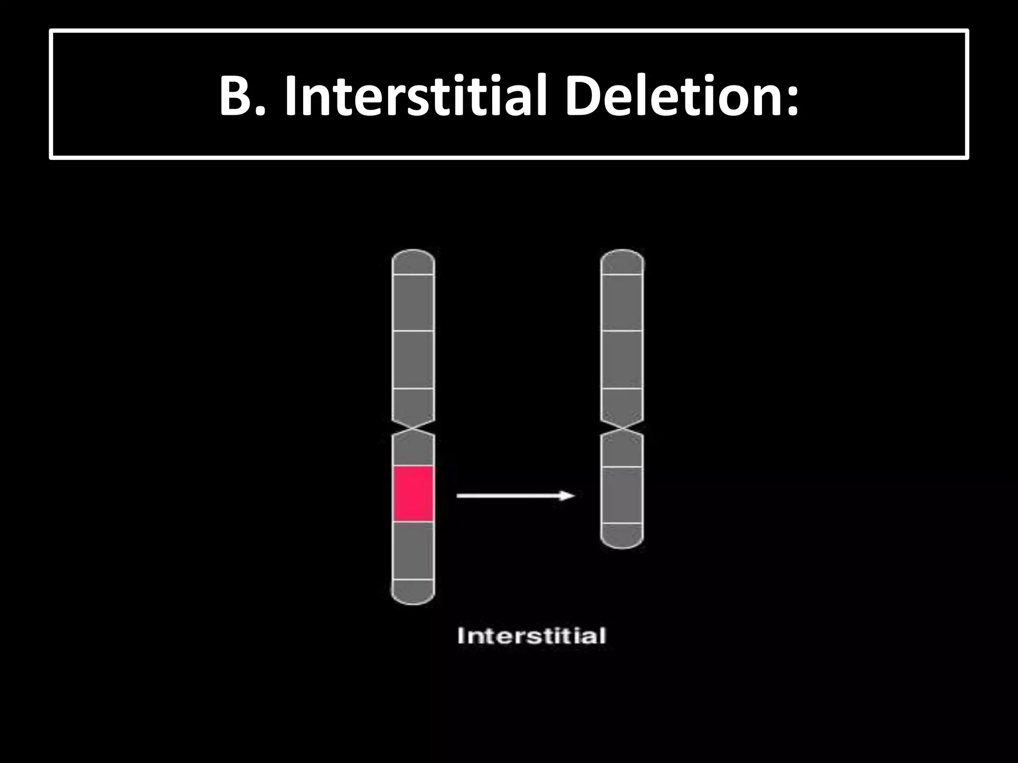 B. Interstitial Deletion:
 