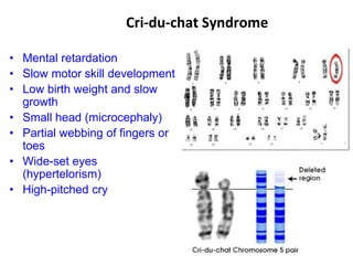 Cri-du-chat Syndrome
• Mental retardation
• Slow motor skill development
• Low birth weight and slow
growth
• Small head (microcephaly)
• Partial webbing of fingers or
toes
• Wide-set eyes
(hypertelorism)
• High-pitched cry
 