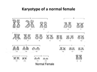 Karyotype of a normal female
 