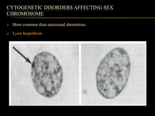 CYTOGENETIC DISORDERS AFFECTING SEX
CHROMOSOME

   More common than autosomal aberrations.

   Lyon hypothesis
 