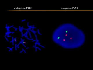 Normal Interphase Fish Chromosomal abnormalities | PPTX