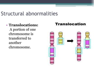 Structural abnormalities
• Translocations:
A portion of one
chromosome is
transferred to
another
chromosome.
 