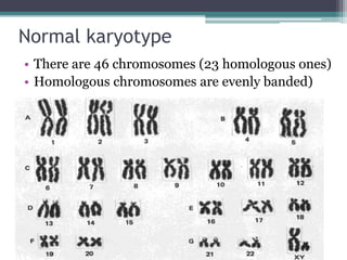Normal karyotype
• There are 46 chromosomes (23 homologous ones)
• Homologous chromosomes are evenly banded)
 