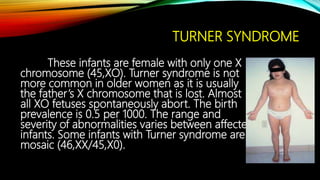 Xo Chromosome Abnormality