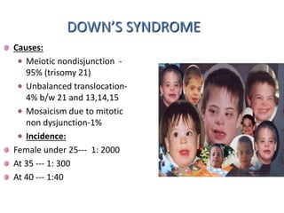 DOWN’S SYNDROME
Causes:
Meiotic nondisjunction -
95% (trisomy 21)
Unbalanced translocation-
4% b/w 21 and 13,14,15
Mosaicism due to mitotic
non dysjunction-1%
Incidence:
Female under 25--- 1: 2000
At 35 --- 1: 300
At 40 --- 1:40
 