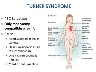TURNER SYNDROME
45 X karyotype
Only monosomy
compatible with life
Cause
Nondisjunction in male
gamete
Structural abnormalities
of X chromosome
One X chromosome is
missing
Mitotic nondisjunction
 