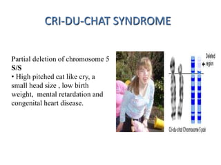 CRI-DU-CHAT SYNDROME
Partial deletion of chromosome 5
S/S
• High pitched cat like cry, a
small head size , low birth
weight, mental retardation and
congenital heart disease.
 