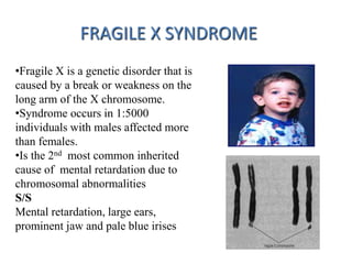 FRAGILE X SYNDROME
•Fragile X is a genetic disorder that is
caused by a break or weakness on the
long arm of the X chromosome.
•Syndrome occurs in 1:5000
individuals with males affected more
than females.
•Is the 2nd most common inherited
cause of mental retardation due to
chromosomal abnormalities
S/S
Mental retardation, large ears,
prominent jaw and pale blue irises
 