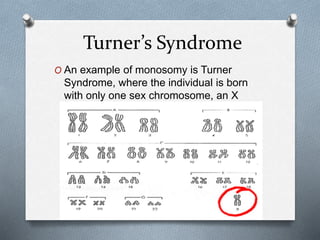 Turner’s Syndrome
O An example of monosomy is Turner
Syndrome, where the individual is born
with only one sex chromosome, an X
 