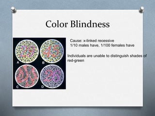 Color Blindness
Cause: x-linked recessive
1/10 males have, 1/100 females have
Individuals are unable to distinguish shades of
red-green
 