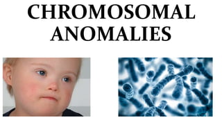 CHROMOSOMAL
ANOMALIES
 