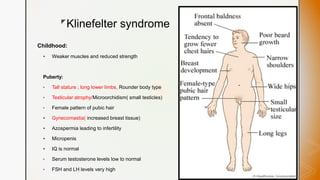 z
Klinefelter syndrome
Childhood:
 Weaker muscles and reduced strength
Puberty:
• Tall stature ; long lower limbs, Rounder body type
• Testicular atrophy/Microorchidism( small testicles)
• Female pattern of pubic hair
 Gynecomastia( increased breast tissue)
 Azospermia leading to infertility
 Micropenis
 IQ is normal
• Serum testosterone levels low to normal
• FSH and LH levels very high
 
