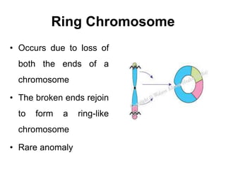 Ring Chromosome
• Occurs due to loss of
both the ends of a
chromosome
• The broken ends rejoin
to form a ring-like
chromosome
• Rare anomaly
 