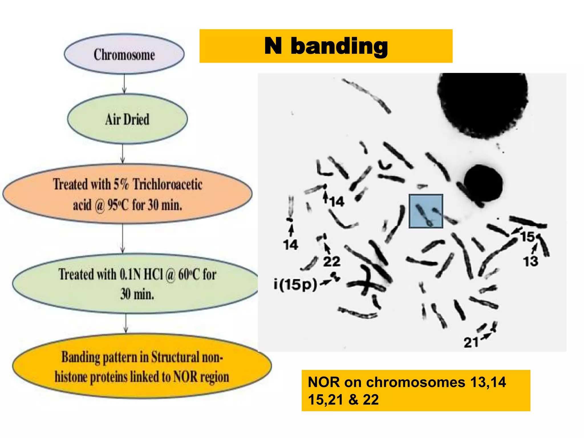 NOR on chromosomes 13,14
15,21 & 22
N banding
 