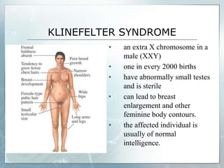 KLINEFELTER SYNDROME
▪ an extra X chromosome in a
male (XXY)
▪ one in every 2000 births
▪ have abnormally small testes
and is sterile
▪ can lead to breast
enlargement and other
feminine body contours.
▪ the affected individual is
usually of normal
intelligence.
 