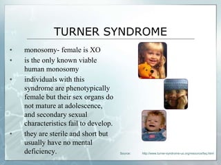 TURNER SYNDROME
▪ monosomy- female is XO
▪ is the only known viable
human monosomy
▪ individuals with this
syndrome are phenotypically
female but their sex organs do
not mature at adolescence,
and secondary sexual
characteristics fail to develop.
▪ they are sterile and short but
usually have no mental
deficiency. Source: http://www.turner-syndrome-us.org/resource/faq.html
 