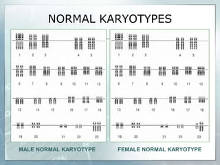 NORMAL KARYOTYPES
FEMALE NORMAL KARYOTYPE
MALE NORMAL KARYOTYPE
 