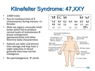 Klinefelter Syndrome: 47,XXY
• 1/600 males
• Due to nondisjunction of X
chromosomes during meiosis I in
females
• Male sex organs; unusually small
testes which fail to produce
normal levels of testosterone
breast enlargement
(gynaecomastia) and other
feminine body characteristics
• Patients are taller and thinner
than average and may have a
slight reduction in IQ but
generally they have normal
intelligence
• No spermatogenesis  sterile
15
 