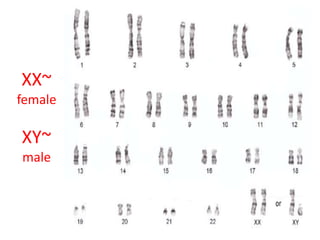 Xy Person chromosomal disorders of the human body.ppt