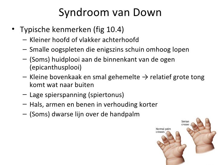 Chromosomale Numeriekeafwijkingentoledoversie