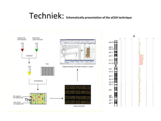 Techniek:  Schematically presentation of the aCGH technique                                                                                       The  