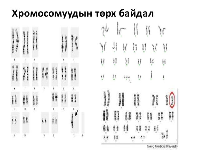Chromosome