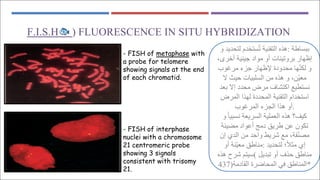 ) FLUORESCENCE IN SITU HYBRIDIZATION
🐟
F.I.S.H
with
metaphase
FISH of
-
a probe for telomere
showing signals at the end
of each chromatid.
- FISH of interphase
nuclei with a chromosome
21 centromeric probe
showing 3 signals
consistent with trisomy
21.
‫ﺑ‬
‫ﺒ‬
‫ﺴ‬
‫ﺎ‬
‫ط‬
‫ﺔ‬
:
‫ھ‬
‫ﺬ‬
‫ه‬
‫ا‬
‫ﻟ‬
‫ﺘ‬
‫ﻘ‬
‫ﻨ‬
‫ﯿ‬
‫ﺔ‬
‫ﺗ‬
ُ
‫ﺴ‬
‫ﺘ‬
‫ﺨ‬
‫ﺪ‬
‫م‬
‫ﻟ‬
‫ﺘ‬
‫ﺤ‬
‫ﺪ‬
‫ﯾ‬
‫ﺪ‬
‫و‬
‫إ‬
‫ظ‬
‫ﮭ‬
‫ﺎ‬
‫ر‬
‫ﺑ‬
‫ﺮ‬
‫و‬
‫ﺗ‬
‫ﯿ‬
‫ﻨ‬
‫ﺎ‬
‫ت‬
‫أ‬
‫و‬
‫ﻣ‬
‫ﻮ‬
‫ا‬
‫د‬
‫ﺟ‬
‫ﯿ‬
‫ﻨ‬
‫ﯿ‬
‫ﺔ‬
‫أ‬
‫ﺧ‬
‫ﺮ‬
‫ى‬
،
‫و‬
‫ﻟ‬
‫ﻜ‬
‫ﻨ‬
ّ
‫ﮭ‬
‫ﺎ‬
‫ﻣ‬
‫ﺤ‬
‫ﺪ‬
‫و‬
‫د‬
‫ة‬
‫ﻹ‬
‫ظ‬
‫ﮭ‬
‫ﺎ‬
‫ر‬
‫ﺟ‬
‫ﺰ‬
‫ء‬
‫ﻣ‬
‫ﺮ‬
‫ﻏ‬
‫ﻮ‬
‫ب‬
‫ﻣ‬
‫ﻌ‬
‫ﯿ‬
ّ
‫ﻦ‬
،
‫و‬
‫ھ‬
‫ﺬ‬
‫ه‬
‫ﻣ‬
‫ﻦ‬
‫ا‬
‫ﻟ‬
‫ﺴ‬
‫ﻠ‬
‫ﺒ‬
‫ﯿ‬
‫ﺎ‬
‫ت‬
‫ﺣ‬
‫ﯿ‬
‫ﺚ‬
‫ﻻ‬
‫ﻧ‬
‫ﺴ‬
‫ﺘ‬
‫ﻄ‬
‫ﯿ‬
‫ﻊ‬
‫ا‬
‫ﻛ‬
‫ﺘ‬
‫ﺸ‬
‫ﺎ‬
‫ف‬
‫ﻣ‬
‫ﺮ‬
‫ض‬
‫ﻣ‬
‫ﺤ‬
‫ﺪ‬
‫د‬
‫إ‬
‫ﻻ‬
‫ﺑ‬
‫ﻌ‬
‫ﺪ‬
‫ا‬
‫ﺳ‬
‫ﺘ‬
‫ﺨ‬
‫ﺪ‬
‫ا‬
‫م‬
‫ا‬
‫ﻟ‬
‫ﺘ‬
‫ﻘ‬
‫ﻨ‬
‫ﯿ‬
‫ﺔ‬
‫ا‬
‫ﻟ‬
‫ﻤ‬
‫ﺤ‬
‫ﺪ‬
‫د‬
‫ة‬
‫ﻟ‬
‫ﮭ‬
‫ﺬ‬
‫ا‬
‫ا‬
‫ﻟ‬
‫ﻤ‬
‫ﺮ‬
‫ض‬
‫أ‬
‫و‬
‫ھ‬
‫ﺬ‬
‫ا‬
‫ا‬
‫ﻟ‬
‫ﺠ‬
‫ﺰ‬
‫ء‬
‫ا‬
‫ﻟ‬
‫ﻤ‬
‫ﺮ‬
‫ﻏ‬
‫ﻮ‬
‫ب‬ .
‫ﻛ‬
‫ﯿ‬
‫ﻒ‬
‫؟‬
‫ھ‬
‫ﺬ‬
‫ه‬
‫ا‬
‫ﻟ‬
‫ﻌ‬
‫ﻤ‬
‫ﻠ‬
‫ﯿ‬
‫ﺔ‬
‫ا‬
‫ﻟ‬
‫ﺴ‬
‫ﺮ‬
‫ﯾ‬
‫ﻌ‬
‫ﺔ‬
‫ﻧ‬
‫ﺴ‬
‫ﺒ‬
‫ﯿ‬
‫ﺎ‬
ً
‫و‬
‫ﺗ‬
‫ﻜ‬
‫ﻮ‬
‫ن‬
‫ﻋ‬
‫ﻦ‬
‫ط‬
‫ﺮ‬
‫ﯾ‬
‫ﻖ‬
‫د‬
‫ﻣ‬
‫ﺞ‬
‫أ‬
‫ﻋ‬
‫ﻮ‬
‫ا‬
‫د‬
‫ﻣ‬
‫ﻀ‬
‫ﯿ‬
‫ﺌ‬
‫ﺔ‬
‫ﻣ‬
‫ﺼ‬
‫ﻨ‬
ّ
‫ﻔ‬
‫ﺔ‬
،
‫ﻣ‬
‫ﻊ‬
‫ﺷ‬
‫ﺮ‬
‫ﯾ‬
‫ﻂ‬
‫و‬
‫ا‬
‫ﺣ‬
‫ﺪ‬
‫ﻣ‬
‫ﻦ‬
‫ا‬
‫ﻟ‬
‫ﺪ‬
‫ي‬
‫إ‬
‫ن‬
‫إ‬
‫ي‬
‫ﻣ‬
‫ﺜ‬
‫ﻼ‬
ً
‫؛‬
‫ﻟ‬
‫ﺘ‬
‫ﺤ‬
‫ﺪ‬
‫ﯾ‬
‫ﺪ‬
:
‫ﻣ‬
‫ﻨ‬
‫ﺎ‬
‫ط‬
‫ﻖ‬
‫ﻣ‬
‫ﻌ‬
‫ﯿ‬
ّ
‫ﻨ‬
‫ﺔ‬
‫أ‬
‫و‬
‫ﻣ‬
‫ﻨ‬
‫ﺎ‬
‫ط‬
‫ﻖ‬
‫ﺣ‬
‫ﺬ‬
‫ف‬
‫أ‬
‫و‬
‫ﺗ‬
‫ﺒ‬
‫ﺪ‬
‫ﯾ‬
‫ﻞ‬
(
‫ﺳ‬
‫ﯿ‬
‫ﺘ‬
‫ﻢ‬
‫ﺷ‬
‫ﺮ‬
‫ح‬
‫ھ‬
‫ﺬ‬
‫ه‬
‫ا‬
‫ﻟ‬
‫ﻤ‬
‫ﻨ‬
‫ﺎ‬
‫ط‬
‫ﻖ‬
‫ﻓ‬
‫ﻲ‬
‫ا‬
‫ﻟ‬
‫ﻤ‬
‫ﺤ‬
‫ﺎ‬
‫ﺿ‬
‫ﺮ‬
‫ة‬
‫ا‬
‫ﻟ‬
‫ﻘ‬
‫ﺎ‬
‫د‬
‫ﻣ‬
‫ﺔ‬
)
437 *
 