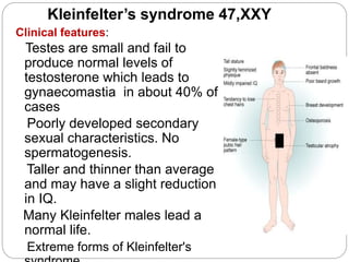 Kleinfelter’s syndrome 47,XXY
Clinical features:
Testes are small and fail to
produce normal levels of
testosterone which leads to
gynaecomastia in about 40% of
cases
Poorly developed secondary
sexual characteristics. No
spermatogenesis.
Taller and thinner than average
and may have a slight reduction
in IQ.
Many Kleinfelter males lead a
normal life.
Extreme forms of Kleinfelter's
 