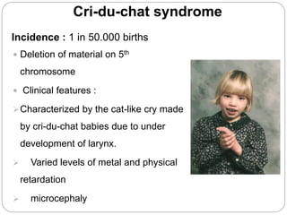 Cri-du-chat syndrome
Incidence : 1 in 50.000 births
 Deletion of material on 5th
chromosome
 Clinical features :
Characterized by the cat-like cry made
by cri-du-chat babies due to under
development of larynx.
 Varied levels of metal and physical
retardation
 microcephaly
 