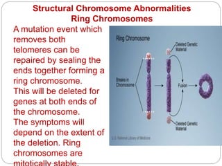 Structural Chromosome Abnormalities
Ring Chromosomes
Ex. Female with ring chrom 4, breakpoints p23.2 and q 12.4 =
46,XX,r(4)(p23.2q12.4)
A mutation event which
removes both
telomeres can be
repaired by sealing the
ends together forming a
ring chromosome.
This will be deleted for
genes at both ends of
the chromosome.
The symptoms will
depend on the extent of
the deletion. Ring
chromosomes are
 