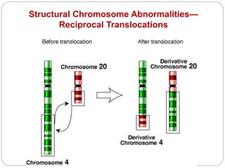 Structural Chromosome Abnormalities—
Reciprocal Translocations
 
