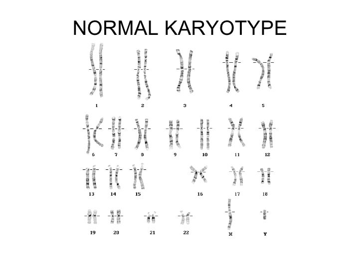 Chromosomes