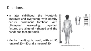 Deletions…
• In later childhood, the hypotonia
improves and overeating with obesity
occurs, prominent forehead with
bitemporal narrowing, palpebral
fissures are almond - shaped and the
hands and feet are small.
• Mental handicap is usual, with an IQ
range of 20 – 80 and a mean of 50.
34
 