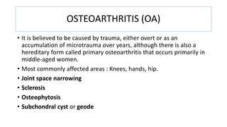 OSTEOARTHRITIS (OA)
• It is believed to be caused by trauma, either overt or as an
accumulation of microtrauma over years, although there is also a
hereditary form called primary osteoarthritis that occurs primarily in
middle-aged women.
• Most commonly affected areas : Knees, hands, hip.
• Joint space narrowing
• Sclerosis
• Osteophytosis
• Subchondral cyst or geode
 