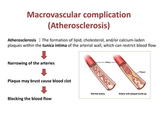 Macrovascular complication
(Atherosclerosis)
Atherosclerosis : The formation of lipid, cholesterol, and/or calcium-laden
plaques within the tunica intima of the arterial wall, which can restrict blood flow
Narrowing of the arteries
Plaque may brust cause blood clot
Blocking the blood flow
 