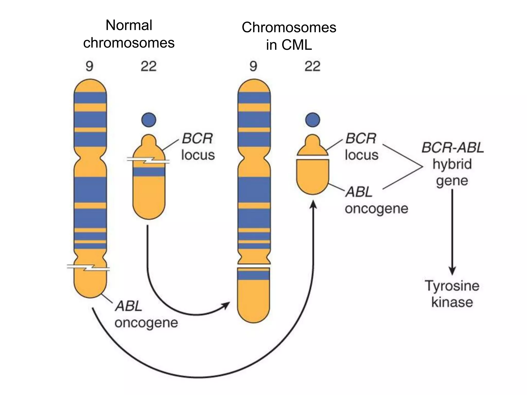 Normal
chromosomes
Chromosomes
in CML
 
