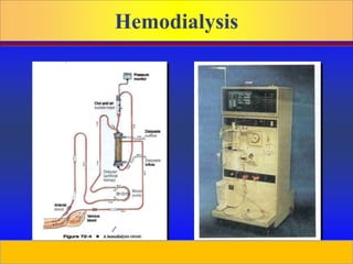 Prepared by D. Chaplin
Hemodialysis
Hemodialysis Machine
Hemodialysis Circuit
 