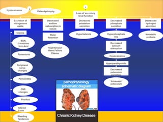 Prepared by D. Chaplin
Hypocalcemia
Osteodystrophy
Excretion of
nitrogenous
waste
Uremia
BUN,
Creatinine
Uric Acid
Proteniuria
Peripheral
nerve
changes
Pericarditis
CNS
changes
Altered
Taste
Bleeding
Tendencie
Decreased
sodium
reabsorption in
tubule
Water
Retention
Hypertension
Heart Failure
Edema
Decreased
potassium
excretion
Hyperkalemia
Decreased
phosphate
excretion
Hyperphosphate
mia
Decreased
calcium
absorption
Hypocalcemia
Hyperparathyroidis
m
Decreased
potassium
excretion
Increased
potassium
Decreased
hydrogen
excretion
Metabolic
acidosis
1
2
a
Loss of excretory
renal function
Pruritus
 