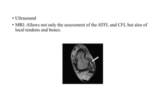 • Ultrasound
• MRI: Allows not only the assessment of the ATFL and CFL but also of
local tendons and bones.
 