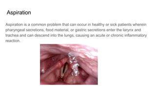 Aspirations Problems Chronic aspiration Chronic aspiration causes | PDF