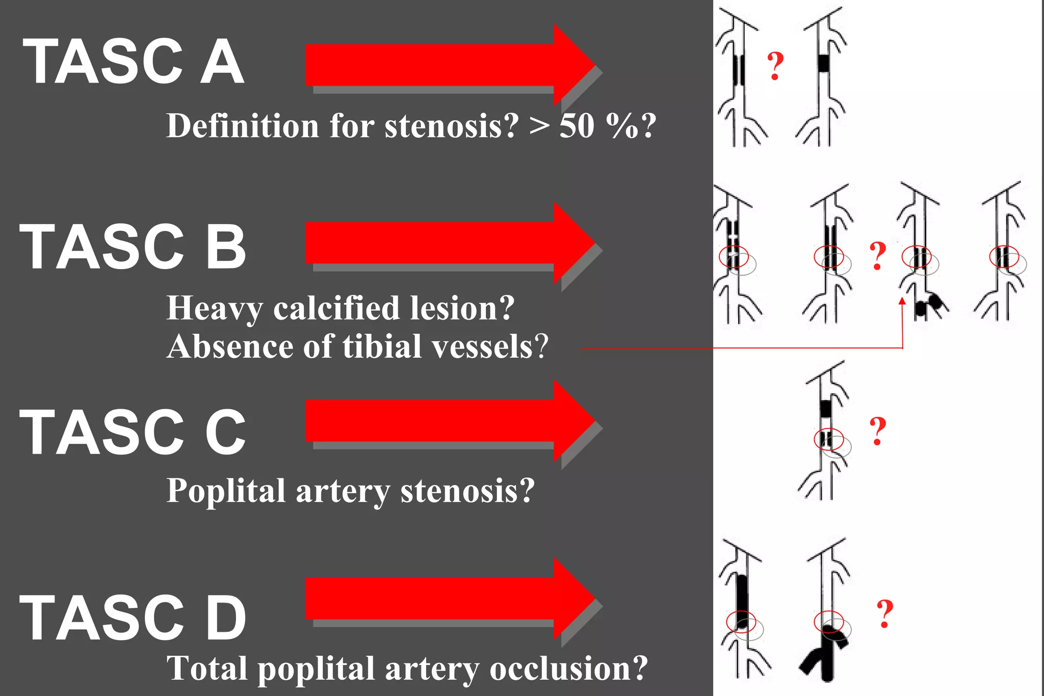 TASC A
TASC B
TASC C
TASC D
Definition for stenosis? > 50 %?
Heavy calcified lesion?
Absence of tibial vessels?
Total poplital artery occlusion?
Poplital artery stenosis?
?
?
?
?
 