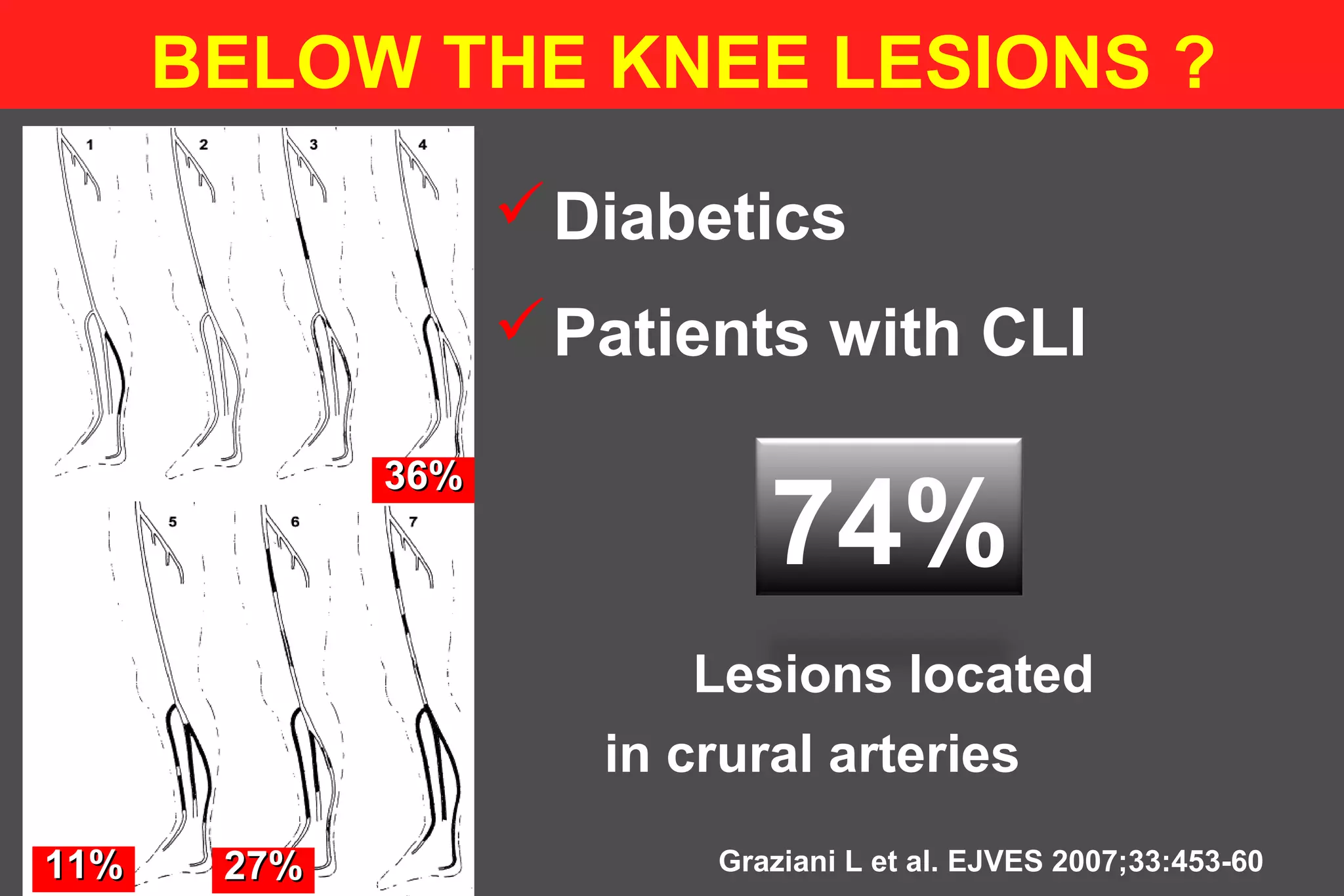 Diabetics
Patients with CLI
Graziani L et al. EJVES 2007;33:453-60
BELOW THE KNEE LESIONS ?
36%36%
11%11% 27%27%
74%
Lesions located
in crural arteries
 