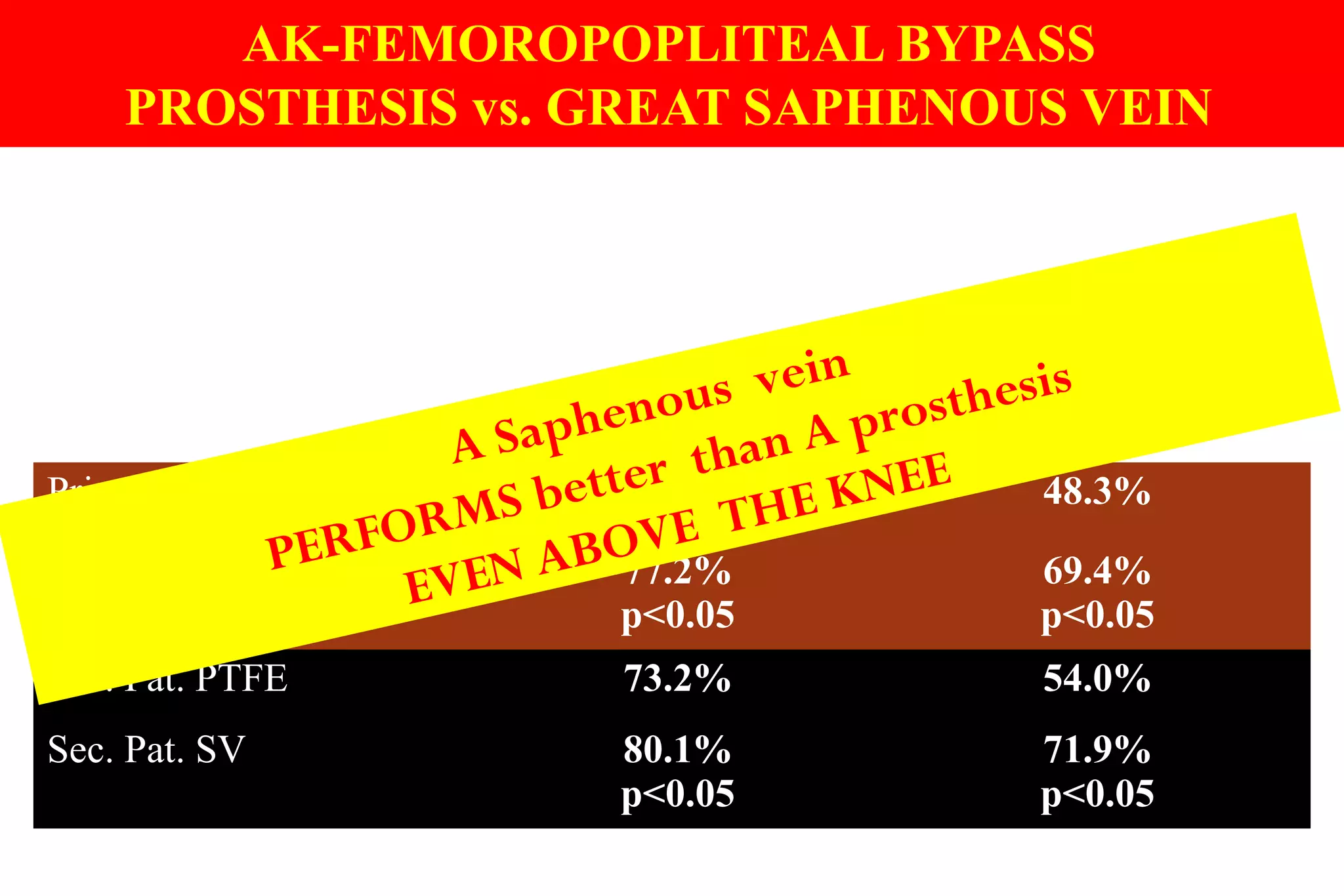AK-FEMOROPOPLITEAL BYPASS
PROSTHESIS vs. GREAT SAPHENOUS VEIN
STUDIES Pereira
2006 Meta-analysis
Pereira
2006 Meta-analysis
Patients
Follow-up
1713 / 580
5 years
2431 / 703
5 years
Symptoms Claudication Critical Ischemia
Prim. Pat. PTFE 57.4% 48.3%
Prim. Pat. SV 77.2%
p<0.05
69.4%
p<0.05
Sec. Pat. PTFE 73.2% 54.0%
Sec. Pat. SV 80.1%
p<0.05
71.9%
p<0.05
A Saphenous vein
PERFORMS better than A prosthesis
EVEN ABOVE THE KNEE
 