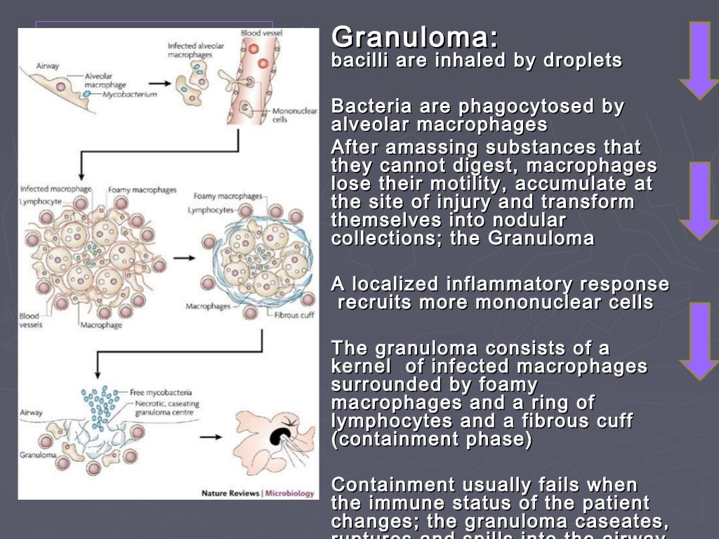 Chronic granulomatous inflammation