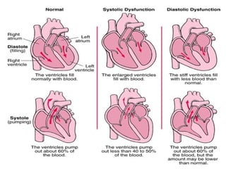 congestive heart failure in the work of GP.pptx