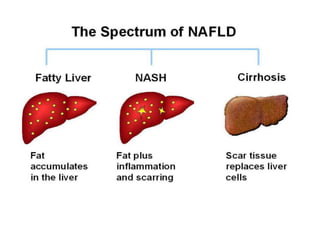 Chronic hepatitis | PPTX